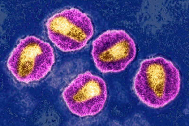 سویه جدید بسیار خطرنا» ویروس «اچ‌ آی‌ وی» در هلند کشف شد