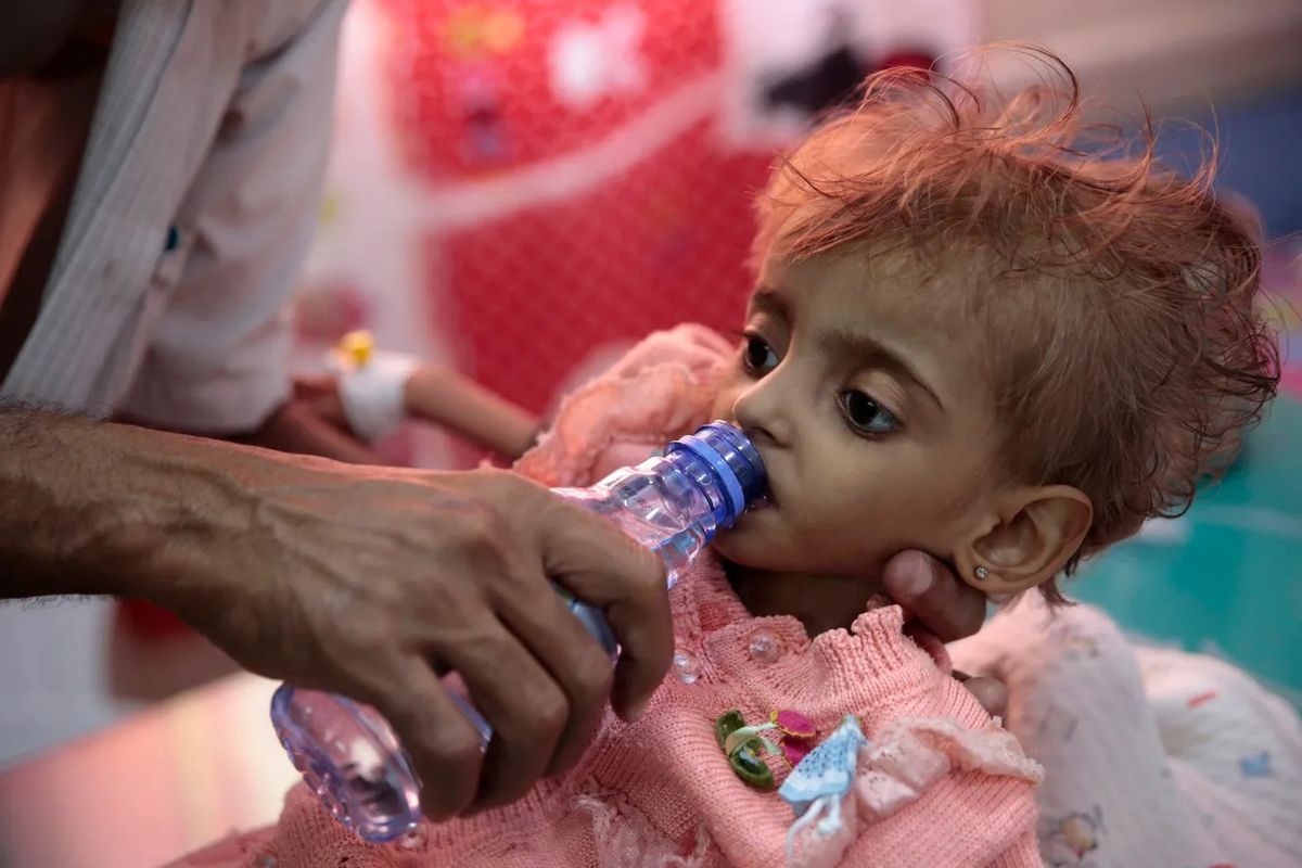 یونیسف: روزانه چهار کودک یمنی کشته یا معلول می‌شوند