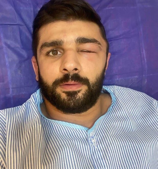 «محمدحسین محمدیان» عضو تیم ملی کشتی آزاد در بیمارستان بستری شد